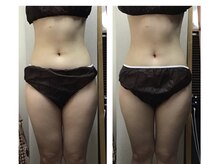 ミマインズ 倉敷本店(Me Mines)/自分磨きスタート！