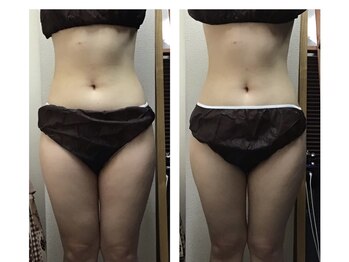 ミマインズ 倉敷本店(Me Mines)/自分磨きスタート!