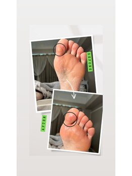 ビンナ 五反田店(Binna)/自分でタコを剥ぐのは危険です!