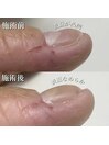 凹凸爪をツルツルに！
