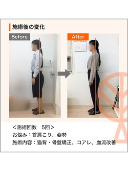 ただき接骨院 整体院 新前橋院/お悩み：首肩こり、姿勢