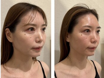 ドクターボディクリスタル(Dr.Body Crystal)/40代