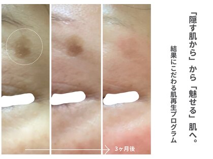 カンパニュラ(campanula)の写真