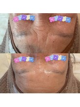 オーノ(Ohno)/シワも改善