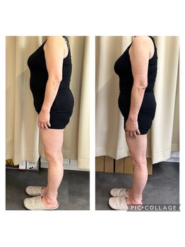 ソニコ 方南町本店(SONICO)/その脂肪あきらめないで!