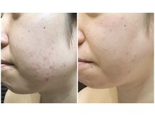 クレビア(CREBIA)/