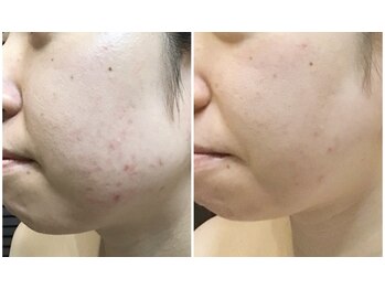 クレビア(CREBIA)/