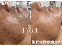 ヴィーダ 渋谷松濤(ViDA)の雰囲気（男性はご紹介制でしたが、男性のご新規様のご予約も可能に◎）