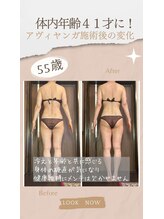 アーユルヴェーダアンドアロマエステ アユス(AYUS)/アーユルヴェーダ施術前後