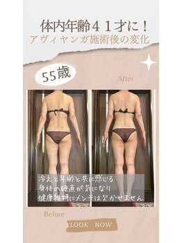 アーユルヴェーダアンドアロマエステ アユス(AYUS)/アーユルヴェーダ施術前後