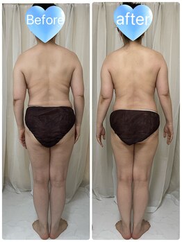 ホロイ(Holo i)/before・ after