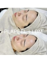 イロハ(IROHA)/プラピール×LDM