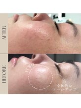 インフィニーズ(INFINEEZ)/カスタマイズ120分美肌改善30代