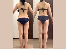 リライブ 亀有店(Re:Lives)/全身ビフォーアフター【痩身】