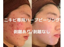 スノースキン(Snow skin)