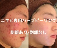 スノースキン(Snow skin)