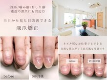 インブロッサム(imblossom)