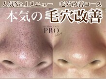 ディンプル(Dimple)