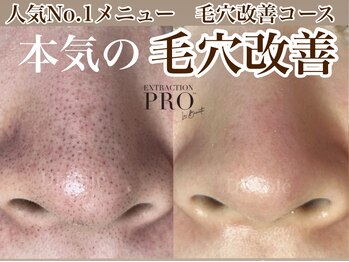 ディンプル(Dimple)