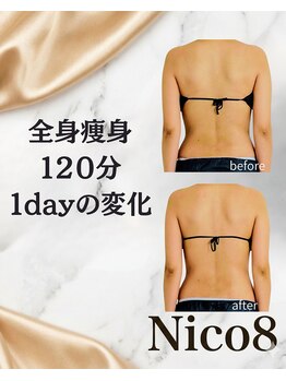 ニコエイト(Nico8)/◇ブライダルエステ◇