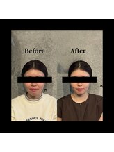 クリアランス 南青山(CLEARANCE)/美容鍼×パルス　担当SAYA