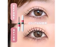 アネラ(anela)の雰囲気(まつげの長さ気になる方ご相談ください*)