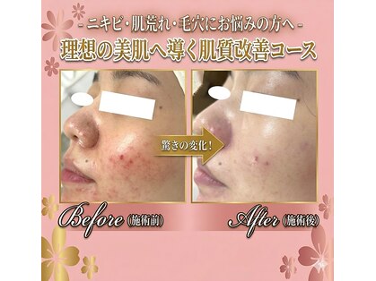 ラポール 野並店(Rapport)の写真