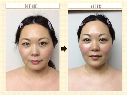 ディグニータココ 自由が丘(DIGNITA coco)の写真