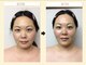 ディグニータココ 自由が丘(DIGNITA coco)の写真