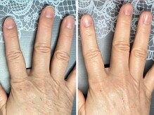 桃の木 吉祥寺店/60代　ハンドケア＆ネイルケア