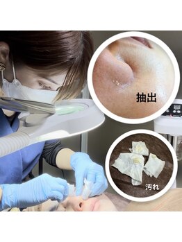 毛穴ケアをしたい