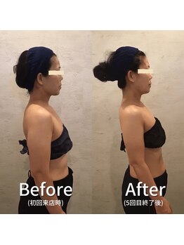 小顔フェイスラボ 大津京駅前店(小顔 Face Labo.)/小顔&整体コルギの変化