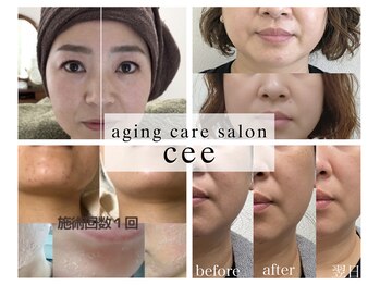 エイジングケアサロンシー(aging care salon cee)