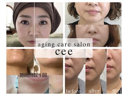 エイジングケアサロンシー(aging care salon cee)の写真