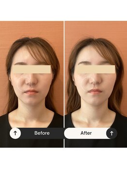 ラクリエ 東加古川院(La Creer)/お客様ビフォーアフター