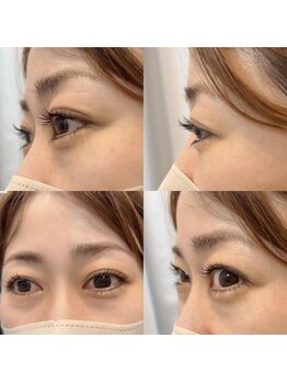 シュエット アイラッシュデザイン(Chouette eyelash design)/どの角度からでも♪