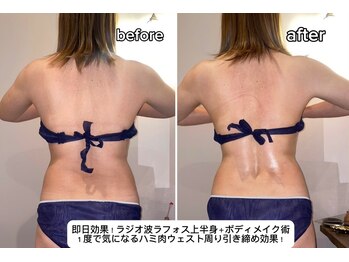 久遠(kuon)/上半身ラフォス痩身!即日効果♪