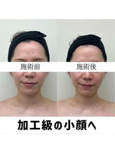 お顔の研究所/ビフォーアフター写真♪