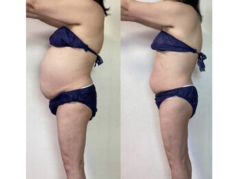 セブンドロップス(7drops)/60代でもここまで変化!