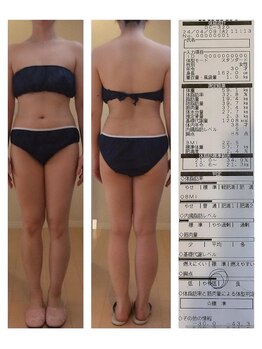 ホロニック ベルサンテ(Holonic Belle Sante)/メディセルハイブリッド