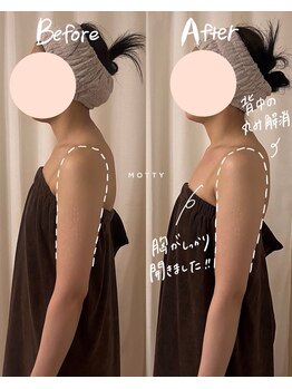 モッティ(MOTTY)/