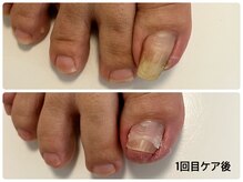 クオーレ(Cuore)の雰囲気（巻き爪を諦めていた方お任せくだい！目立たない透明プレート使用）