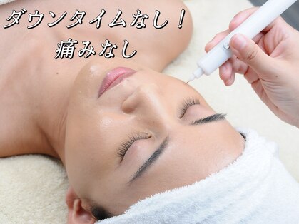 ルンルン(run run)の写真