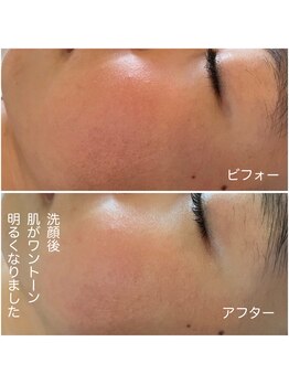 オーノ(Ohno)/垢取り洗顔でトーンアップ！