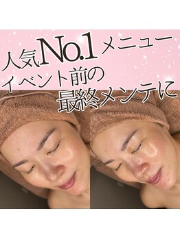 あすはれ/クリスマス前の肌メンテナンスに