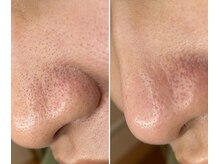 サイ(Sai)/before⇒after