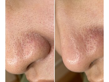 サイ(Sai)/before⇒after