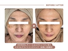 イエス マイサロン(yes My Salon)/ENVIRONトリートメント症例