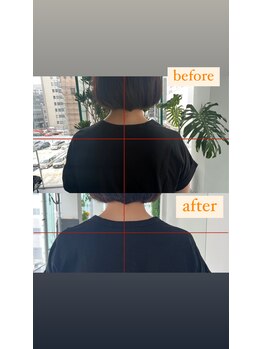 エムイー(ME)/肩が疲れやすい