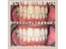 ライトビューティー 池袋店(LightBeauty)/症例写真